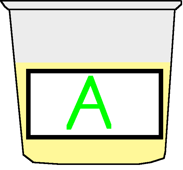 Sampel Urine